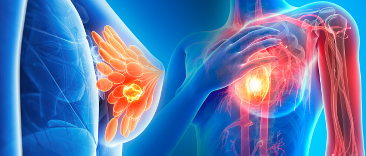 CANCER IS A THREAT TO OUR PEOPLE